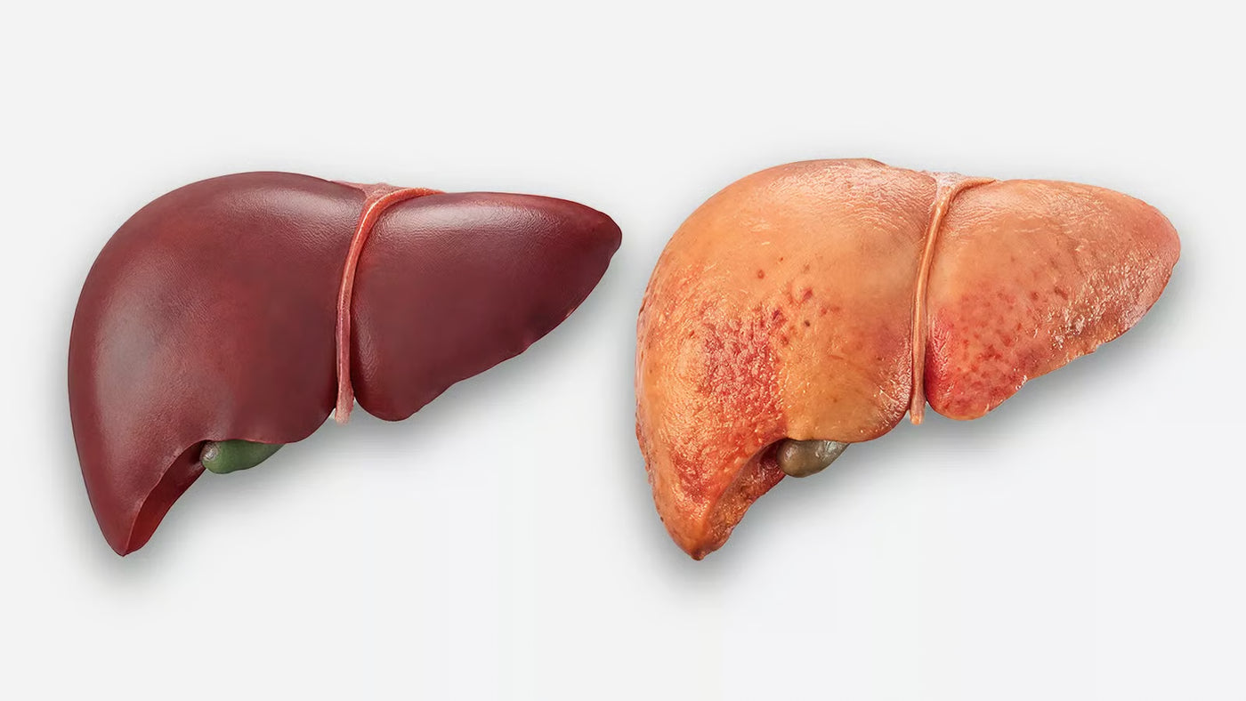 Doctor discussing liver health with patient